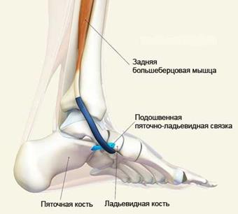 Лечение косточки на ноге в воронеже