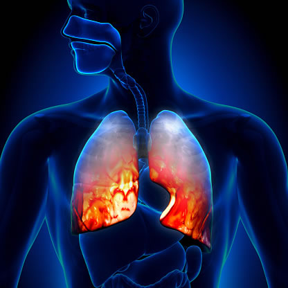 Бронхиальная астма и саркоидоз